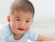 skin-rashes-babies-concept